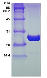 Recombinant Human Ubiquitin-conjugating Enzyme E2 K, His