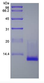 Recombinant Murine Cuteaneous T-cell Attracting Chemokine/CCL27