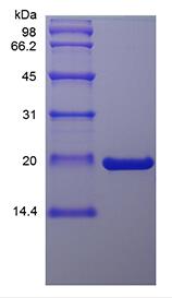 Recombinant Murine Oncostatin-M