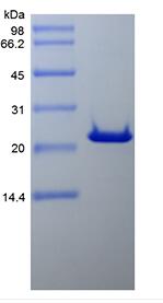 Recombinant Human B-cell Lymphoma 2