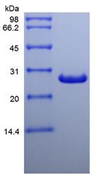 Recombinant Human Galectin-3