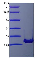 Recombinant Murine Interleukin-21