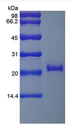 Recombinant Human soluble Tumor Necrosis Factor Receptor Type II/TNFRSF1B