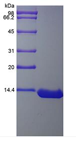 Recombinant HBV Surface Antigen-preS1
