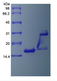 Recombinant Human Interleukin-17